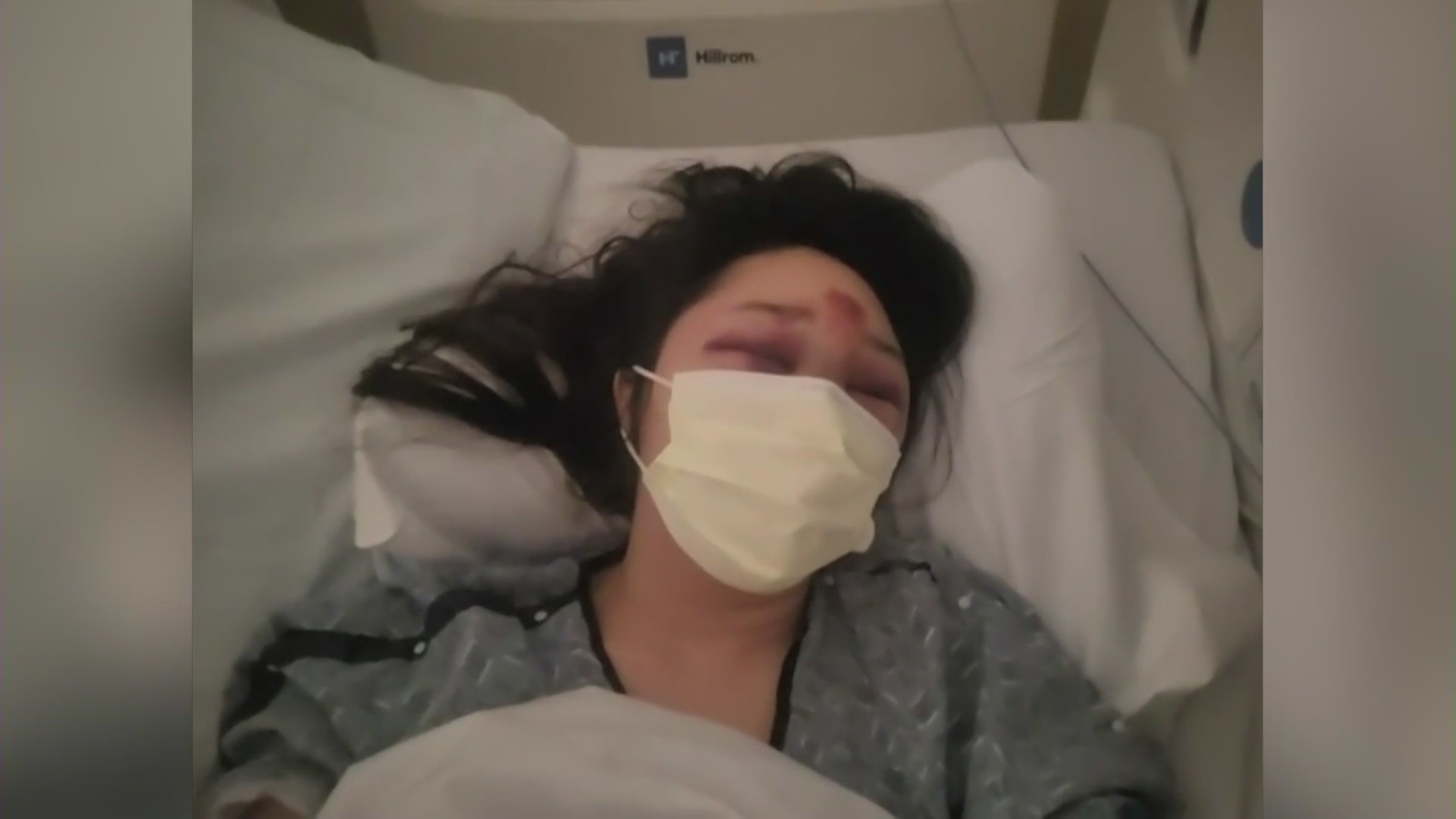 The 37-year-old victim of a violent purse snatching on Nov. 26, 2023 in the City of Industry speaks from her hospital bed at Pomona Valley Hospital on Nov. 28, 2023. (KTLA)