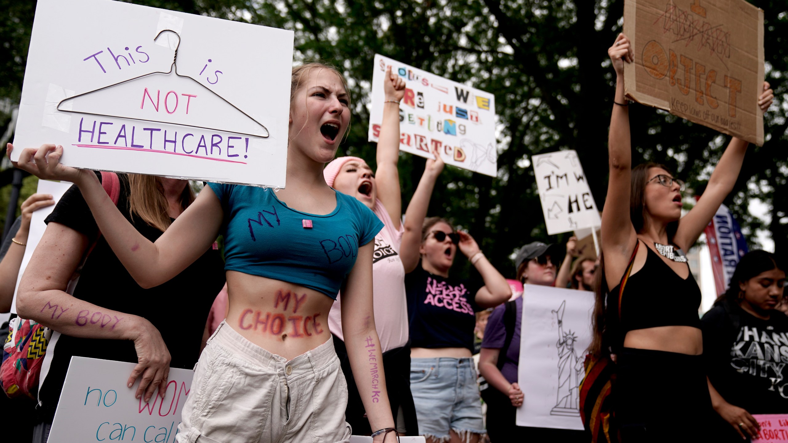 FILE - People rally in support of abortion rights, July 2, 2022, in Kansas City, Mo. Legislative efforts in Missouri and Mississippi this week are attempting to prevent voters from having a say over abortion rights, building on anti-abortion strategies seen in other states, including last year in Ohio. (AP Photo/Charlie Riedel, File)