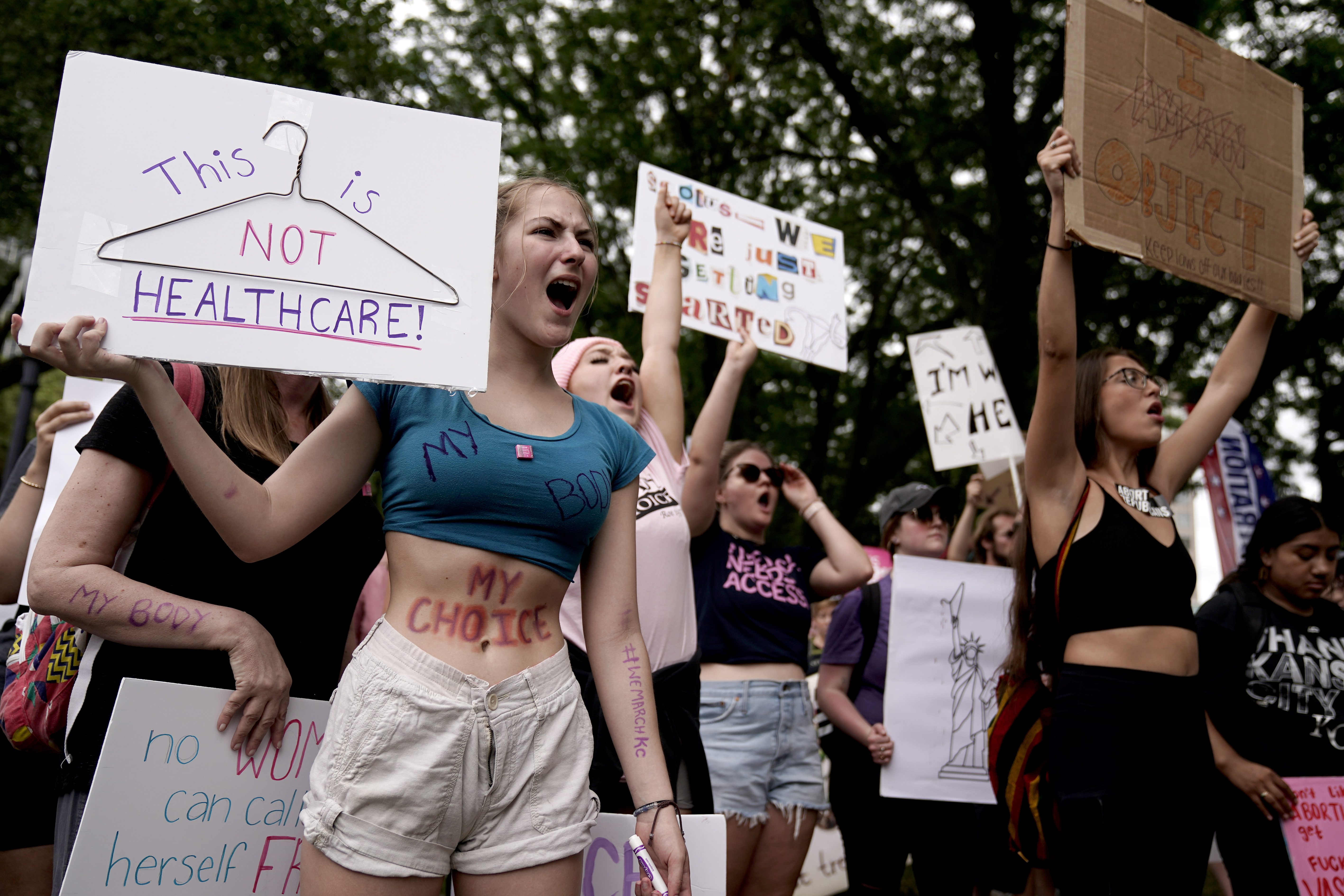 FILE - People rally in support of abortion rights, July 2, 2022, in Kansas City, Mo. Legislative efforts in Missouri and Mississippi this week are attempting to prevent voters from having a say over abortion rights, building on anti-abortion strategies seen in other states, including last year in Ohio. (AP Photo/Charlie Riedel, File)