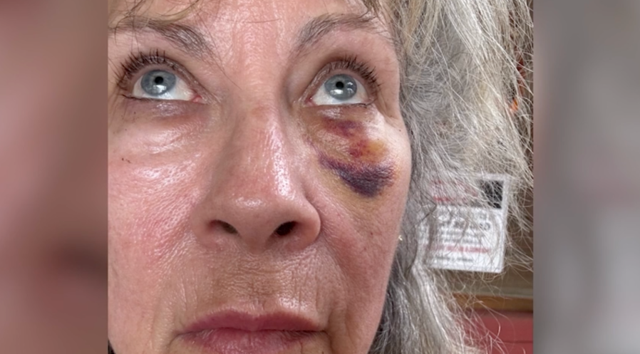 California woman violently attacked in road-rage incident