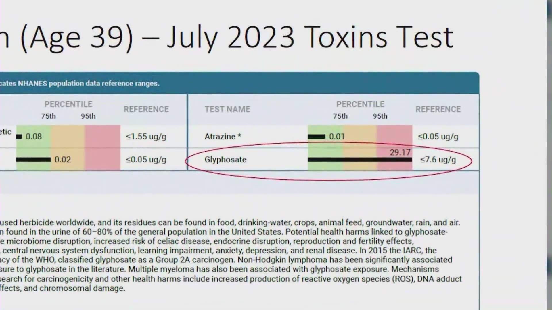 Carolyn McCuan's test result shows she had over 18 times the amount of glufosinate in her urine than 95% of women her age. (Carolyn McCuan)