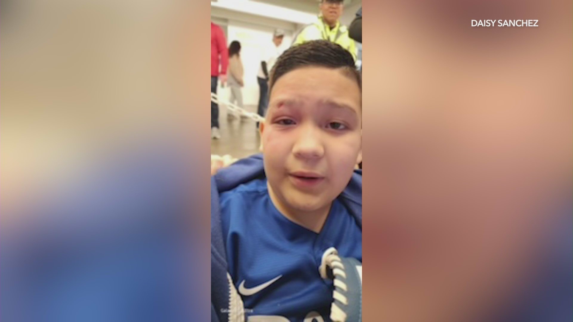 Eight-year-old Nathan Sanchez being tended to by medical officials after being hit in the face by a foul ball at Dodgers Stadium on May 17, 2024. (Sanchez Family)