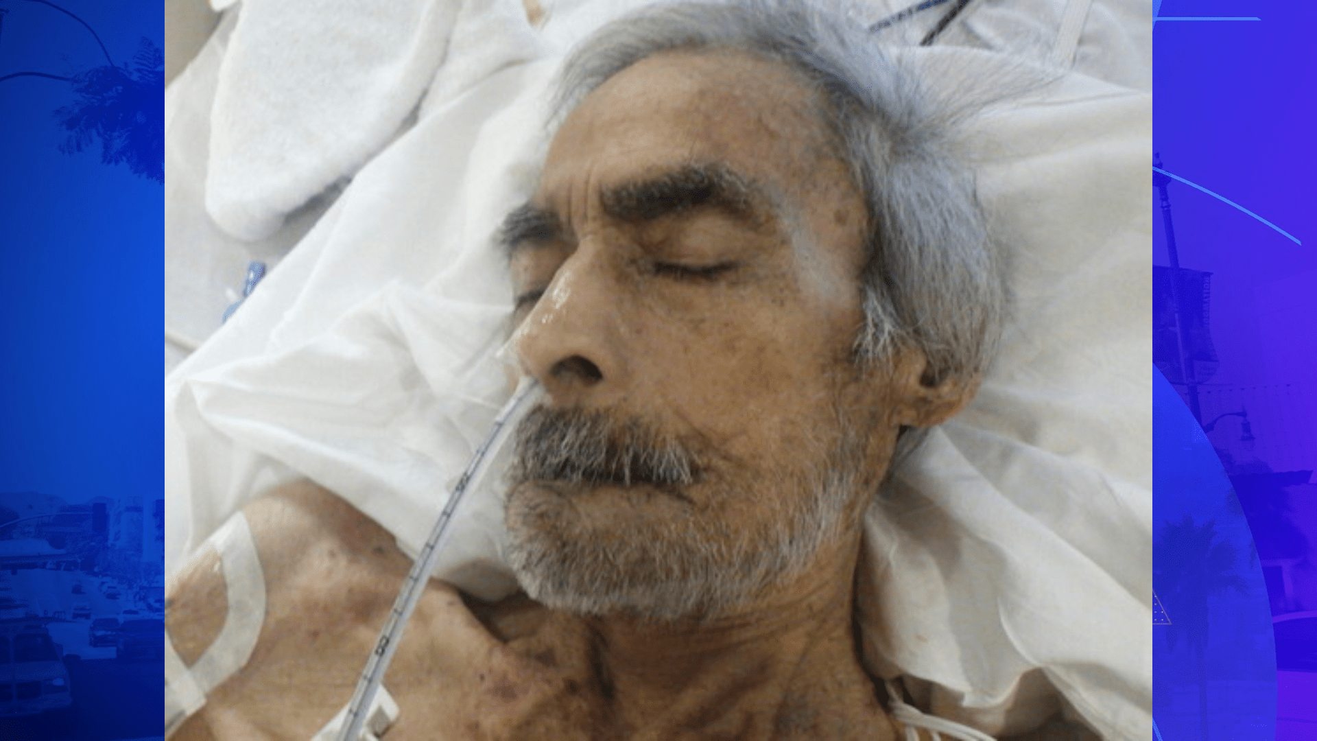 Hospital staff need help identifying a male patient in his 70s who has been hospitalized since June 4, 2024. (Los Angeles General Medical Center)