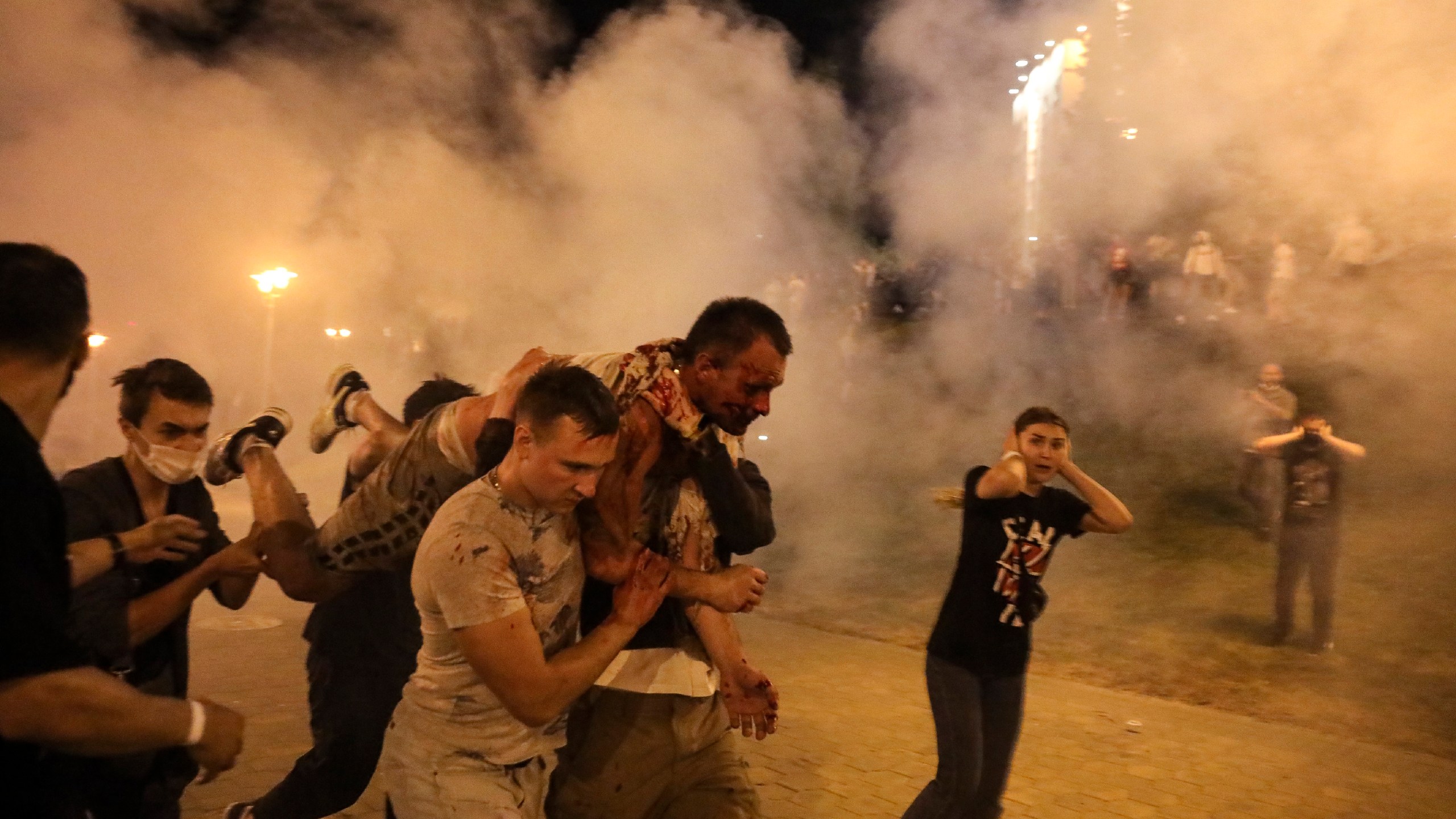 FILE - Protesters carry a man injured during clashes with police amid demonstrations in Minsk, Belarus, on Aug. 10, 2020. (AP Photo, File)