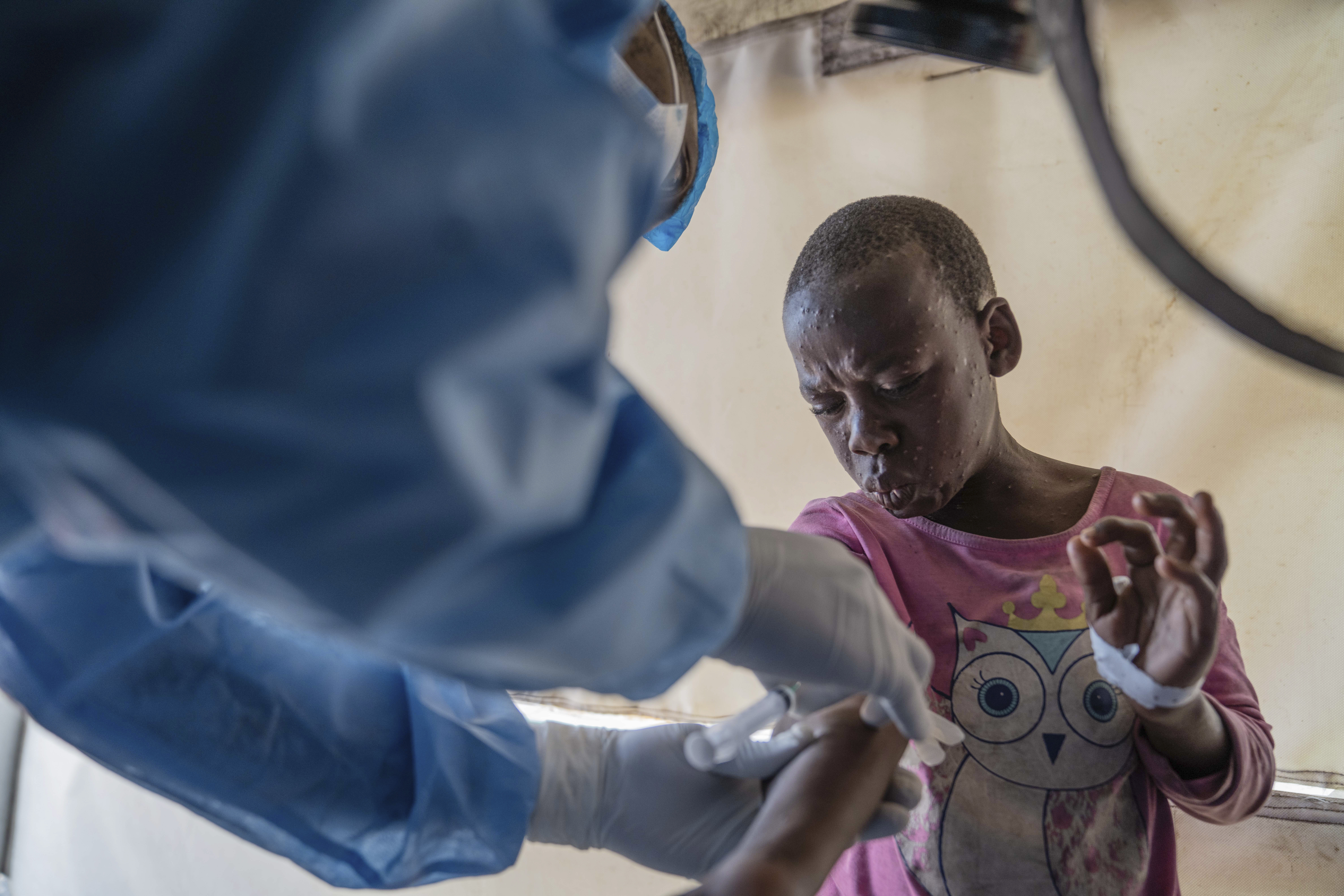 FILE - A health worker attends to a mpox patient, at a treatment centre in Munigi, eastern Congo, Aug. 19, 2024. (AP Photo/Moses Sawasawa, file )