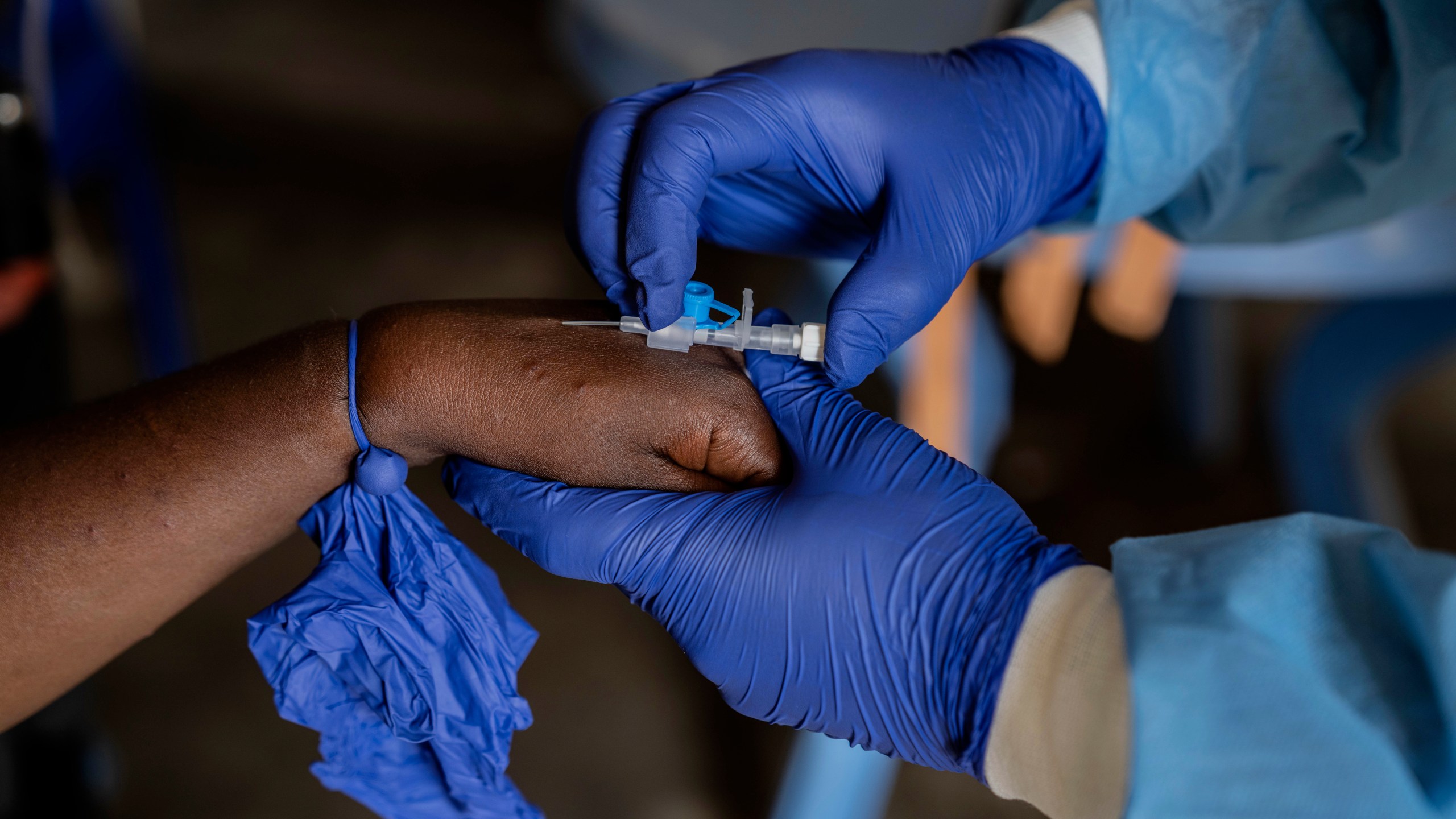 FILE - A health worker attends to a mpox patient, at a treatment centre in Munigi, eastern Congo, Aug. 16, 2024. (AP Photo/Moses Sawasawa, file )