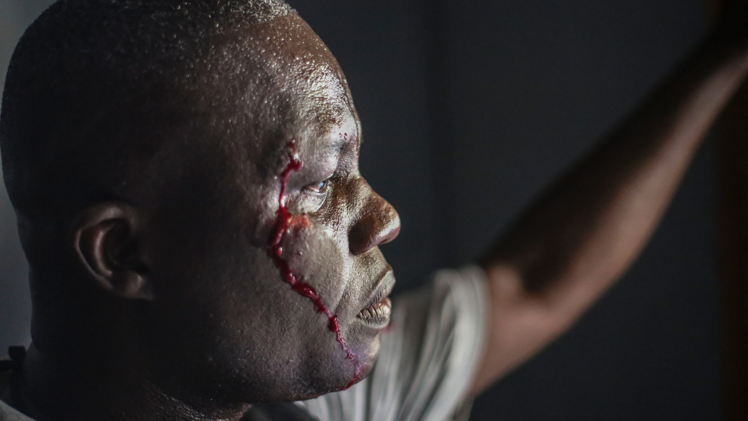 A wounded security officer looks on after being shot by armed gangs at the General Hospital in Port-au-Prince, Haiti, Tuesday, Dec. 24, 2024. (AP Photo/Jean Feguens Regala)