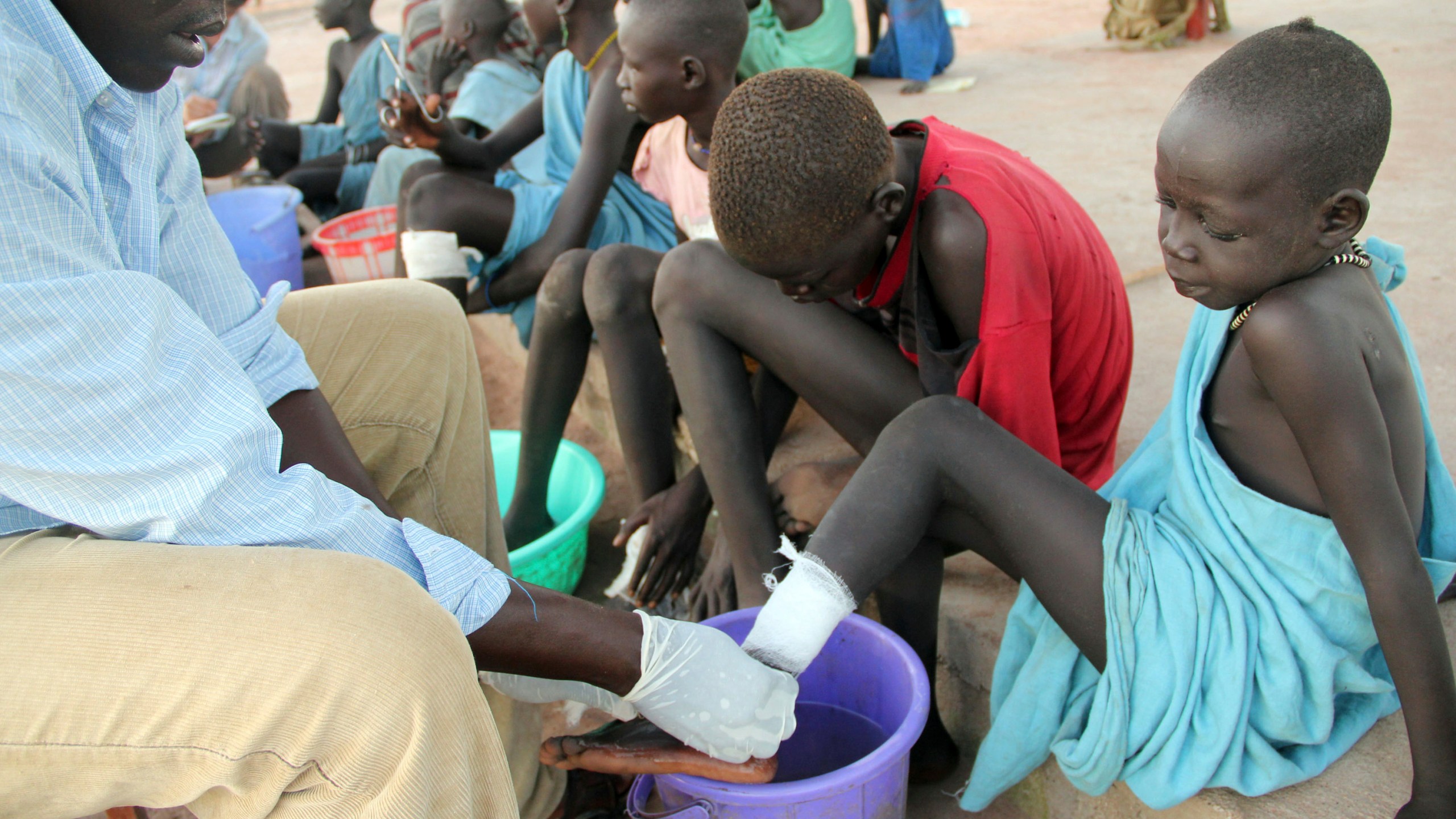 FILE - In this Nov. 4, 2010 photo, Ajak Kuol Nyamchiek, 7, watches while John Lotiki, a nurse with the Carter Center, bandages the blister on her leg from where a guinea worm is slowly emerging in Abuyong, Sudan. (AP Photo/Maggie Fick, File)