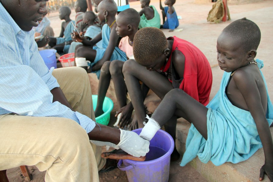 FILE - In this Nov. 4, 2010 photo, Ajak Kuol Nyamchiek, 7, watches while John Lotiki, a nurse with the Carter Center, bandages the blister on her leg from where a guinea worm is slowly emerging in Abuyong, Sudan. (AP Photo/Maggie Fick, File)